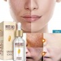 Уцінка. Сироватка для обличчя освiтлююча, з екстрактом  рису, Rorec Rice Skin Beauty Essence, 15 мл