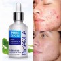 Сироватка від запалень та висипань для проблемної шкіри BIOAQUA Pure Skin, 30 мл